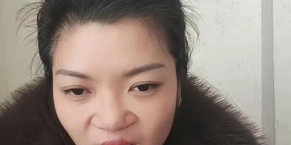 bob半岛体育-震惊！为声援李亚鹏，一漂亮女孩坦然展示自己唇腭裂手术前后照片